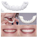 Snap On Veneers